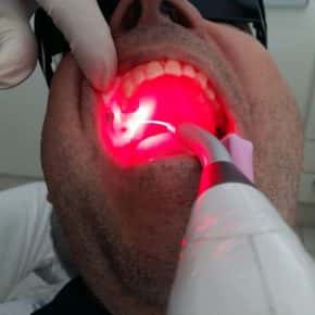 Terapia Fotodinâmica ou Fotônica em Odontologia